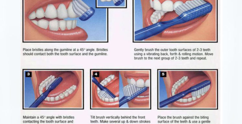 Proper Brushing